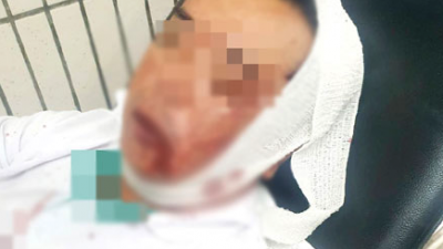 45岁殡葬业职员遭火葬场员工殴打，导致男子头部重伤不省人事！